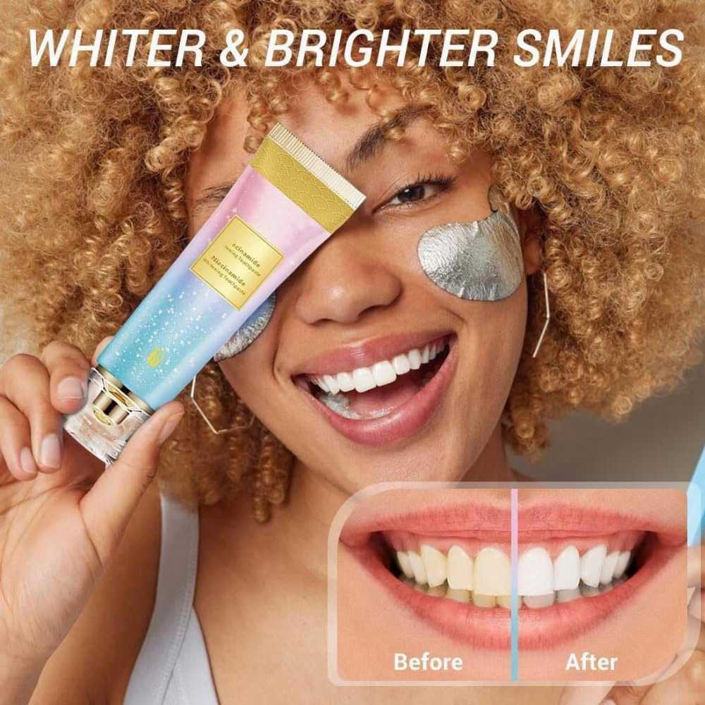 Niacinamide Whitening Toothpaste – Removes Stains, Whitens Teeth Naturally 🌸